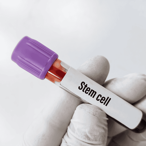 Revolutionary Stem Cell Treatments for Neurological Conditions in Mexico City: Inside MexStemCells Clinic’s Success